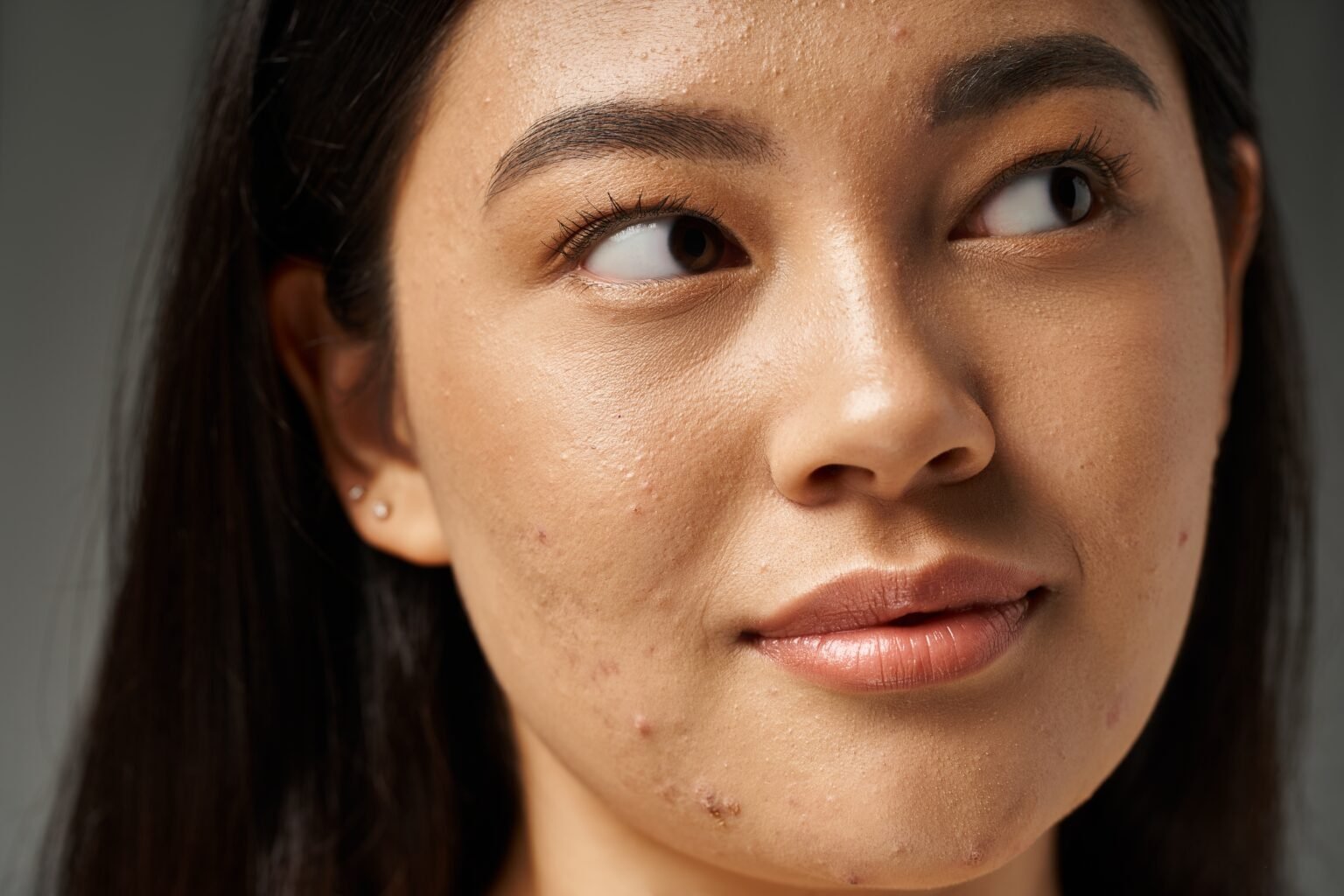 Do You Have a Compromised Skin Barrier? Here’s How to Help